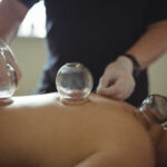 Cupping